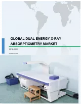 Global Dual Energy X-ray Absorptiometry Market 2018-2022